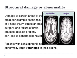 Biological Approach in explaining Abnormality & Psychological Disorders ...