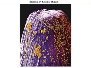 Bacteria on the point of a pin
 