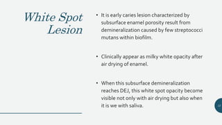 White Spot
Lesion
• It is early caries lesion characterized by
subsurface enamel porosity result from
demineralization caused by few streptococci
mutans within biofilm.
• Clinically appear as milky white opacity after
air drying of enamel.
• When this subsurface demineralization
reaches DEJ, this white spot opacity become
visible not only with air drying but also when
it is we with saliva. 12
 