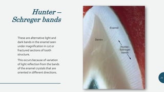 Hunter –
Schreger bands
These are alternative light and
dark bands in the enamel seen
under magnification in cut or
fractured sections of tooth
structure.
This occurs because of variation
of light reflection from the bands
of the enamel crystals that are
oriented in different directions.
24
 