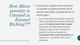 How Micro
porosity is
Created in
Enamel
Etching???
• As you know crystals in the enamel rod
run parallel to length of enamel rods &
enamel rods always run perpendicular to
tooth surface
– So, the rods which are present in that wall
which is perpendicular to tooth surface will
expose the sides of rods & their crystals
during acid etching & while those rods
which are present in that wall which is
parallel to surface will expose the
transverse section or face of crystals and
create micro – porosities in the core of
these rods.
26
 