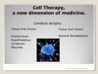 Tissue first choice:
Frontal brain
Hypothalamus
Cerebrum
Placenta
Biological Health Center Mallorca S.L
Tissue 2nd choice:
General Revitalisation
Cerebral atrophy
 
