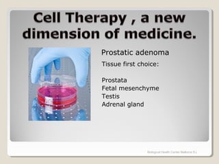 Tissue first choice:
Prostata
Fetal mesenchyme
Testis
Adrenal gland
Biological Health Center Mallorca S.L
Prostatic adenoma
 
