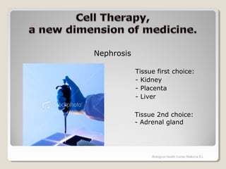 Tissue first choice:
- Kidney
- Placenta
- Liver
Biological Health Center Mallorca S.L
Nephrosis
Tissue 2nd choice:
- Adrenal gland
 