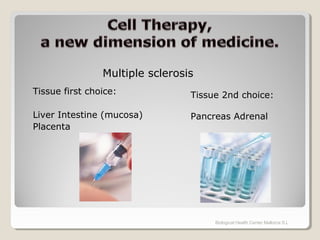 Tissue first choice:
Liver Intestine (mucosa)
Placenta
Biological Health Center Mallorca S.L
Multiple sclerosis
Tissue 2nd choice:
Pancreas Adrenal
 