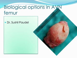 Biological options in AVN
femur
 Dr. Sushil Paudel
 
