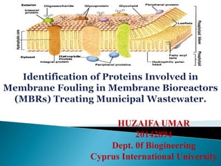 HUZAIFA UMAR
20142894
Dept. 0f Biogineering
Cyprus International University
 