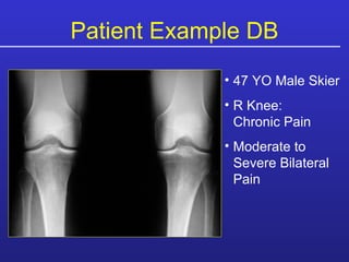 Patient Example DB 47 YO Male Skier R Knee:  Chronic Pain Moderate to Severe Bilateral Pain 