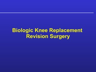 Biologic Knee Replacement  Revision Surgery 