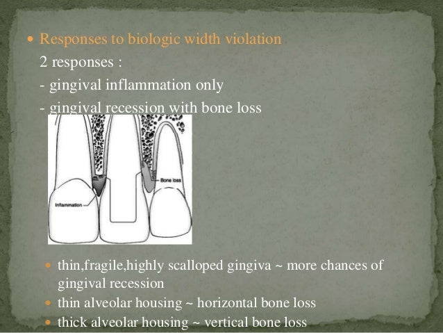biologic width