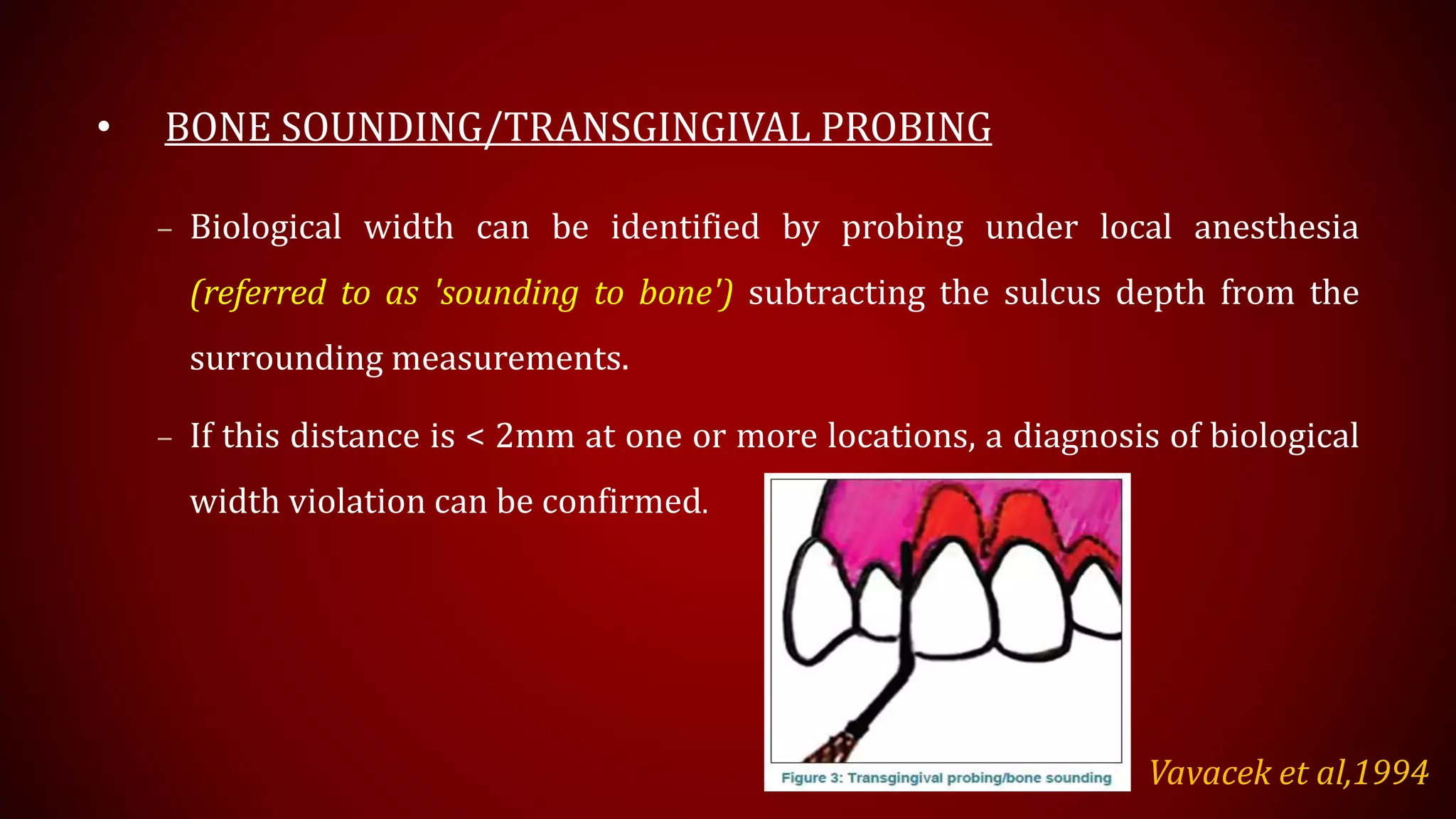 • BONE SOUNDING/TRANSGINGIVAL PROBING
– Biological width can be identified by probing under local anesthesia
(referred to as 'sounding to bone') subtracting the sulcus depth from the
surrounding measurements.
– If this distance is < 2mm at one or more locations, a diagnosis of biological
width violation can be confirmed.
Vavacek et al,1994
 