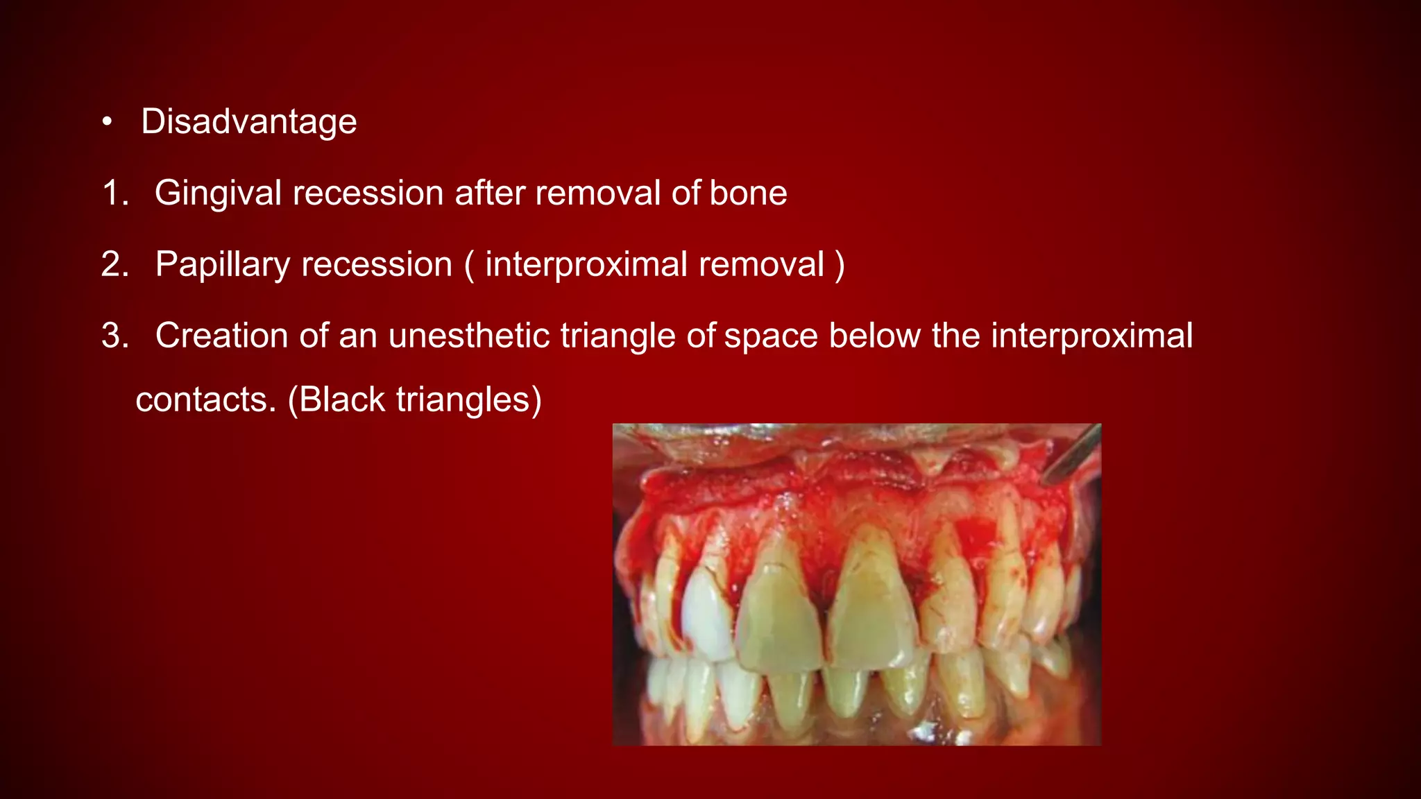 • Disadvantage
1. Gingival recession after removal of bone
2. Papillary recession ( interproximal removal )
3. Creation of an unesthetic triangle of space below the interproximal
contacts. (Black triangles)
 