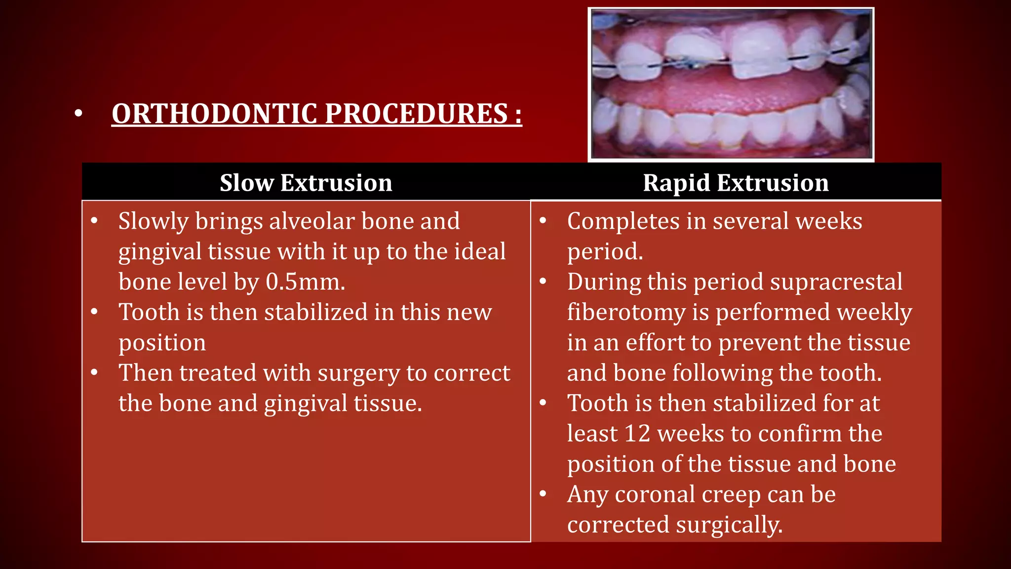 • ORTHODONTIC PROCEDURES :
Slow Extrusion Rapid Extrusion
• Slowly brings alveolar bone and
gingival tissue with it up to the ideal
bone level by 0.5mm.
• Tooth is then stabilized in this new
position
• Then treated with surgery to correct
the bone and gingival tissue.
• Completes in several weeks
period.
• During this period supracrestal
fiberotomy is performed weekly
in an effort to prevent the tissue
and bone following the tooth.
• Tooth is then stabilized for at
least 12 weeks to confirm the
position of the tissue and bone
• Any coronal creep can be
corrected surgically.
 