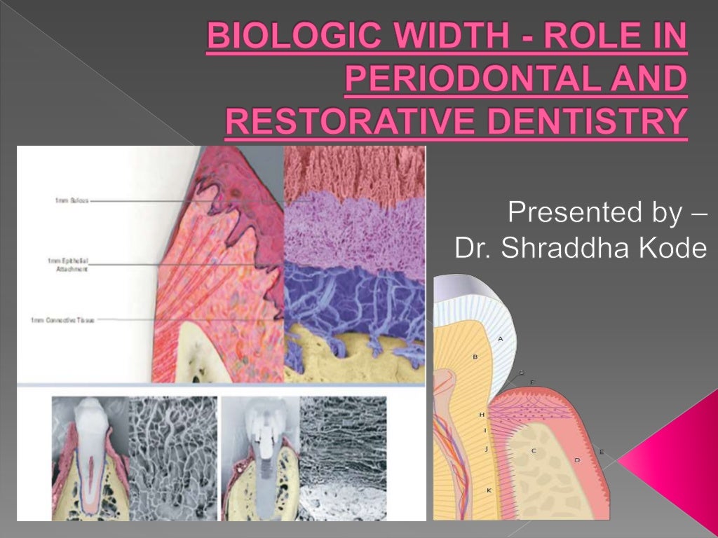Biologic width Importance in Periodontal and Restorative Dentistry