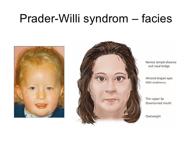 Biologie pro bakaláře - Cytogenetika II