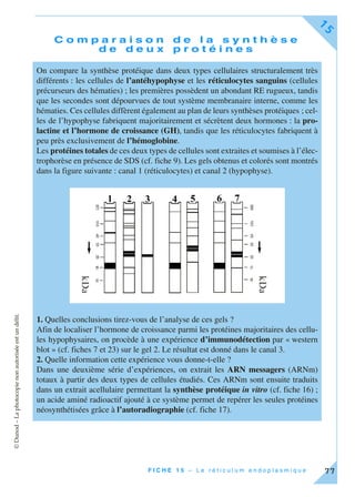 ©Dunod–Laphotocopienonautoriséeestundélit.
F I C H E 1 5 – L e r é t i c u l u m e n d o p l a s m i q u e
15
77
C o m p a r a i s o n d e l a s y n t h è s e
d e d e u x p r o t é i n e s
On compare la synthèse protéique dans deux types cellulaires structuralement très
différents : les cellules de l’antéhypophyse et les réticulocytes sanguins (cellules
précurseurs des hématies) ; les premières possèdent un abondant RE rugueux, tandis
que les secondes sont dépourvues de tout système membranaire interne, comme les
hématies. Ces cellules diffèrent également au plan de leurs synthèses protéiques ; cel-
les de l’hypophyse fabriquent majoritairement et sécrètent deux hormones : la pro-
lactine et l’hormone de croissance (GH), tandis que les réticulocytes fabriquent à
peu près exclusivement de l’hémoglobine.
Les protéines totales de ces deux types de cellules sont extraites et soumises à l’élec-
trophorèse en présence de SDS (cf. fiche 9). Les gels obtenus et colorés sont montrés
dans la figure suivante : canal 1 (réticulocytes) et canal 2 (hypophyse).
1. Quelles conclusions tirez-vous de l’analyse de ces gels ?
Afin de localiser l’hormone de croissance parmi les protéines majoritaires des cellu-
les hypophysaires, on procède à une expérience d’immunodétection par « western
blot » (cf. fiches 7 et 23) sur le gel 2. Le résultat est donné dans le canal 3.
2. Quelle information cette expérience vous donne-t-elle ?
Dans une deuxième série d’expériences, on extrait les ARN messagers (ARNm)
totaux à partir des deux types de cellules étudiés. Ces ARNm sont ensuite traduits
dans un extrait acellulaire permettant la synthèse protéique in vitro (cf. fiche 16) ;
un acide aminé radioactif ajouté à ce système permet de repérer les seules protéines
néosynthétisées grâce à l’autoradiographie (cf. fiche 17).
 