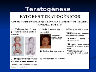 Teratogênese
Teratogênese
 