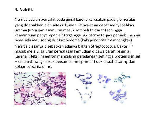 Hipertensi Dapat Berdampak Pada Ginjal