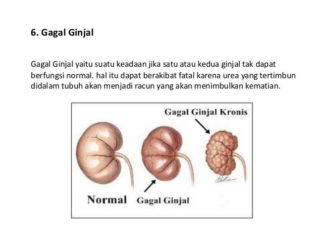 Kelainan Dan Penyakit Pada Ginjal