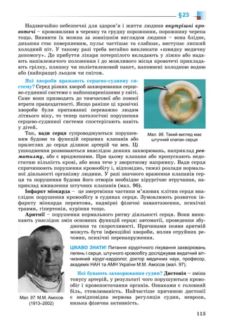 113
§23
Íàäçâè÷àéíî íåáåçïå÷íі äëÿ çäîðîâ’ÿ і æèòòÿ ëþäèíè âíóòðіøíі êðî-
âîòå÷і – êðîâîâèëèâè â ÷åðåâíó òà ãðóäíó ïîðîæíèíè, ïîðîæíèíó ÷åðåïà
òîùî. Âèÿâèòè їõ ìîæíà çà çîâíіøíіì âèãëÿäîì ëþäèíè – âîíà áëіäíå,
äèõàííÿ ñòàє ïîâåðõíåâèì, ïóëüñ ÷àñòіøàє òà ñëàáøàє, âèñòóïàє ëèïêèé
õîëîäíèé ïіò. Ó òàêîìó ðàçі òðåáà íåãàéíî âèêëèêàòè «øâèäêó ìåäè÷íó
äîïîìîãó». Äî ïðèáóòòÿ ëіêàðÿ ïîòåðïіëîãî âêëàäàþòü ó ëіæêî àáî íàäà-
þòü íàïіâëåæà÷îãî ïîëîæåííÿ і äî ìîæëèâîãî ìіñöÿ êðîâîòå÷і ïðèêëàäà-
þòü ãðіëêó, ïëÿøêó ÷è ïîëіåòèëåíîâèé ïàêåò, íàïîâíåíі õîëîäíîþ âîäîþ
àáî (íàéêðàùå) ëüîäîì ÷è ñíіãîì.
ßêі õâîðîáè âðàæàþòü ñåðöåâî-ñóäèííó ñè-
ñòåìó? Ñåðåä ðіçíèõ õâîðîá çàõâîðþâàííÿ ñåðöå-
âî-ñóäèííîї ñèñòåìè є íàéïîøèðåíіøèìè ó ñâіòі.
Ñàìå âîíè ïðèçâîäÿòü äî òèì÷àñîâîї àáî ïîâíîї
âòðàòè ïðàöåçäàòíîñòі. ßêùî ðàíіøå öі õðîíі÷íі
õâîðîáè áóëè ïðèòàìàííі ïåðåâàæíî ëþäÿì
ëіòíüîãî âіêó, òî òåïåð ïàòîëîãі÷íі ïîðóøåííÿ
ñåðöåâî-ñóäèííîї ñèñòåìè ñïîñòåðіãàþòü íàâіòü
ó äіòåé.
Òàê, âàäè ñåðöÿ ñóïðîâîäæóþòüñÿ ïîðóøåí-
íÿì áóäîâè òà ôóíêöіé ñåðöåâèõ êëàïàíіâ àáî
ïðèëåãëèõ äî ñåðöÿ äіëÿíîê àðòåðіé ÷è âåí. Öі
óøêîäæåííÿ ðîçâèâàþòüñÿ âíàñëіäîê äåÿêèõ çàõâîðþâàíü, íàïðèêëàä ðåâ-
ìàòèçìó, àáî є âðîäæåíèìè. Ïðè öüîìó êëàïàíè àáî ïðîïóñêàþòü íåäî-
ñòàòíþ êіëüêіñòü êðîâі, àáî âîíà òå÷å ó çâîðîòíîìó íàïðÿìêó. Âàäè ñåðöÿ
ñïðè÷èíþþòü ïîðóøåííÿ êðîâîîáіãó і, âіäïîâіäíî, òÿæêі ðîçëàäè íîðìàëü-
íîї äіÿëüíîñòі îðãàíіçìó ëþäèíè. Ó ðàçі çíà÷íîãî âðàæåííÿ êëàïàíіâ ñåð-
öÿ òà ïîðóøåííÿ áóäîâè éîãî îòâîðіâ íåîáõіäíå õіðóðãі÷íå âòðó÷àííÿ, íà-
ïðèêëàä âæèâëåííÿ øòó÷íèõ êëàïàíіâ (ìàë. 96).
Іíôàðêò ìіîêàðäà – öå çìåðòâіííÿ ÷àñòèíè ì’ÿçîâèõ êëіòèí ñåðöÿ âíà-
ñëіäîê ïîðóøåííÿ êðîâîîáіãó â ñóäèíàõ ñåðöÿ. Çóìîâëþþòü ðîçâèòîê іí-
ôàðêòó ìіîêàðäà ïåðåâòîìà, íàäìіðíі ôіçè÷íі íàâàíòàæåííÿ, ïñèõі÷íі
òðàâìè, ãіïåðòîíіÿ, êóðіííÿ òîùî.
Àðèòìії – ïîðóøåííÿ íîðìàëüíîãî ðèòìó äіÿëüíîñòі ñåðöÿ. Âîíè âèíè-
êàþòü óíàñëіäîê çìіí îñíîâíèõ ôóíêöіé ñåðöÿ: àâòîìàòії, ïðîâåäåííÿ çáó-
äæåííÿ òà ñêîðîòëèâîñòі. Ïðè÷èíàìè ïîÿâè àðèòìіé
ìîæóòü áóòè іíôåêöіéíі õâîðîáè, âïëèâ îòðóéíèõ ðå-
÷îâèí, ïñèõі÷íі ïåðåíàïðóæåííÿ.
ЦІКАВО ЗНАТИ! Питання хірургічного лікування захворювань
легень і серця, штучного кровообігу досліджував видатний віт-
чизняний хірург-кардіолог, доктор медичних наук, професор,
академік НАН та АМН України М.М. Амосов (мал. 97).
ßêі áóâàþòü çàõâîðþâàííÿ ñóäèí? Äèñòîíіÿ – çìіíà
òîíóñó àðòåðіé, ó ðåçóëüòàòі ÷îãî ïîðóøóþòüñÿ êðîâî-
îáіã і êðîâîïîñòà÷àííÿ îðãàíіâ. Îçíàêàìè є ãîëîâíèé
áіëü, ñòîìëþâàíіñòü. Íàé÷àñòіøå ïðè÷èíîþ äèñòîíії
є íåâіäïîâіäíà íåðâîâà ðåãóëÿöіÿ ñóäèí, íåâðîçè,
íèçüêà ôіçè÷íà àêòèâíіñòü.
Мал. 97. М.М. Амосов
(1913–2002)
Мал. 96. Такий вигляд має
штучний клапан серця
 