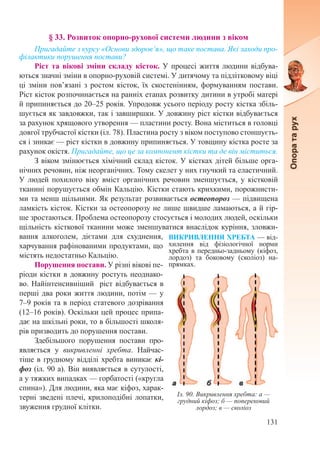 131
§ 33. Розвиток опорно-рухової системи людини з віком
Пригадайте з курсу «Основи здоров’я», що таке постава. Які заходи про-
філактики порушення постави?
Ріст та вікові зміни складу кісток. У процесі життя людини відбува-
ються значні зміни в опорно-руховій системі. У дитячому та підлітковому віці
ці зміни пов’язані з ростом кісток, їх скостенінням, формуванням постави.
Ріст кісток розпочинається на ранніх етапах розвитку дитини в утробі матері
й припиняється до 20–25 років. Упродовж усього періоду росту кістка збіль-
шується як завдовжки, так і завширшки. У довжину ріст кістки відбувається
за рахунок хрящового утворення — пластини росту. Вона міститься в головці
довгої трубчастої кістки (іл. 78). Пластина росту з віком поступово стоншуєть-
ся і зникає — ріст кістки в довжину припиняється. У товщину кістка росте за
рахунок окістя. Пригадайте, що це за компонент кістки та де він міститься.
З віком змінюється хімічний склад кісток. У кістках дітей більше орга-
нічних речовин, ніж неорганічних. Тому скелет у них гнучкий та еластичний.
У людей похилого віку вміст органічних речовин зменшується, у кістковій
тканині порушується обмін Кальцію. Кістки стають крихкими, порожнисти-
ми та менш щільними. Як результат розвивається остеопороз — підвищена
ламкість кісток. Кістки за остеопорозу не лише швидше ламаються, а й гір-
ше зростаються. Проблема остеопорозу стосується і молодих людей, оскільки
щільність кісткової тканини може зменшуватися внаслідок куріння, зловжи-
вання алкоголем, дієтами для схуднення,
харчування рафінованими продуктами, що
містять недостатньо Кальцію.
Порушення постави. У різні вікові пе-
ріоди кістки в довжину ростуть неоднако-
во. Найінтенсивніший ріст відбувається в
перші два роки життя людини, потім — у
7–9 років та в період статевого дозрівання
(12–16 років). Оскільки цей процес припа-
дає на шкільні роки, то в більшості школя-
рів призводить до порушення постави.
Здебільшого порушення постави про-
являється у викривленні хребта. Найчас-
тіше в грудному відділі хребта виникає кі-
фоз (іл. 90 а). Він виявляється в сутулості,
а у тяжких випадках — горбатості («кругла
спина»). Для людини, яка має кіфоз, харак-
терні зведені плечі, крилоподібні лопатки,
звуження грудної клітки.
Іл. 90. Викривлення хребта: а —
грудний кіфоз; б — поперековий
лордоз; в — сколіоз
ВИКРИВЛЕННЯ ХРЕБТА — від-
хилення від фізіологічної норми
хребта в передньо-задньому (кіфоз,
лордоз) та боковому (сколіоз) на-
прямках.
 