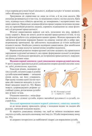 133
ється нервова регуляція їхньої діяльності, відбувається ріст м’язових волокон,
тобто збільшується маса м’яза.
Тренування діє сприятливо не лише на м’язи, а й на стан скелета. Що
сильніше розвиваються м’язи тіла, то міцнішими стають і кістки скелета. Крім
того, підвищується стійкість організму до захворювань і несприятливих чин-
ників довкілля. Правильно дозована фізична праця і вправи позитивно вплива-
ють на гармонійний розвиток людини, сприяють підвищенню не лише фізич-
ної, а й розумової працездатності.
Фізичні навантаження корисні для всіх, незалежно від віку, професії,
стану здоров’я. Якщо ви хочете досягти високої працездатності м’язів, то під
час фізичної роботи слід дотримувати певних правил. Фізично працювати або
займатися фізичними вправами бажано на свіжому повітрі або в добре про-
вітрюваному приміщенні. Це забезпечить надходження до м’язів необхідної
кількості кисню. Необхідно уникати надмірних навантажень. Для запобігання
перевтомі за появи відчуття значної втоми потрібно відпочити.
Нормальний розвиток опорно-рухової системи залежить від правильного
харчування та рухової активності, що сприяє формуванню сильної та витрива-
лої людини. Гіподинамія призводить до погіршення працездатності, порушен-
ня обміну речовин тощо.
Надання першої допомоги у разі ушкодження опорно-рухової системи.
У житті людини трапляються різні ушкодження опорно-рухової системи: виви-
хи, забої, розтягнення, переломи.
Унаслідок різких, надмірних ру-
хів у суглобі, сильного удару в ділянку
суглоба можливий вивих — зміщення
кінців кісток, що його утворюють.
При цьому головка однієї кістки част-
ково або повністю виходить із сугло-
бової западини іншої (іл. 92). Вивих
можуть супроводжувати розриви су-
глобової сумки, розтягнення суглобо-
вих зв’я́зок і м’язів.
Ознаками вивихів є: зміна фор-
ми кінцівки в ділянці суглоба, втрата звичайної рухливості в суглобі, го-
стрий біль.
Загальні принципи надання першої допомоги у випадку вивихів:
а) до місця вивиху прикладіть грілку з холодною водою чи льодом або
рушник, змочений холодною водою;
б) закріпіть ушкоджену кінцівку так, щоб не змінити положення виви-
хнутого суглоба, накладіть косинкову пов’язку (іл. 93) або імпровізовану шину
(іл. 95);
в) доправте потерпілого до найближчої лікарні для вправляння суглоба.
Іл. 92. Плечовий суглоб:
а — у нормі; б — вивих
 