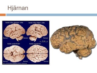 Hjärnan 
 