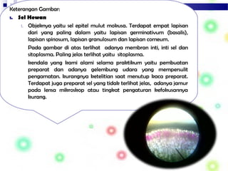 Keterangan Gambar:
1. Sel Hewan
1. Objeknya yaitu sel epitel mulut mokusa. Terdapat empat lapisan
dari yang paling dalam yaitu lapisan germinativum (basalis),
lapisan spinosum, lapisan granulosum dan lapisan corneum.
Pada gambar di atas terlihat adanya membran inti, inti sel dan
sitoplasma. Paling jelas terlihat yaitu sitoplasma.
kendala yang kami alami selama praktikum yaitu pembuatan
preparat dan adanya gelembung udara yang mempersulit
pengamatan. kurangnya ketelitian saat menutup kaca preparat.
Terdapat juga preparat sel yang tidak terlihat jelas, adanya jamur
pada lensa mikroskop atau tingkat pengaturan kefokusannya
kurang.
 