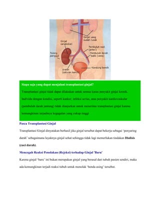 Pelajaran dari kasus transplantasi ginjal ilegal