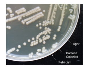 Agar


      Bacteria
      Colonies
Petri dish
 