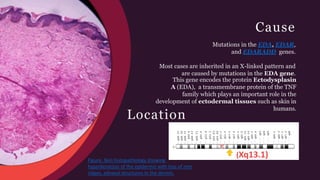 Biology 100 - Genetic Disorders | PPTX