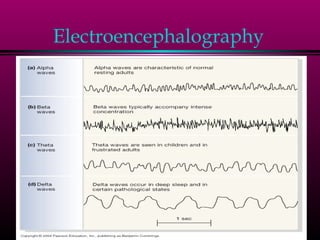 Electroencephalography
 