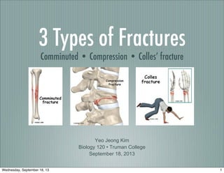 3 Types of Fractures
Comminuted • Compression • Colles’ fracture
Yeo Jeong Kim
Biology 120 • Truman College
September 18, 2013
1Wednesday, September 18, 13
 