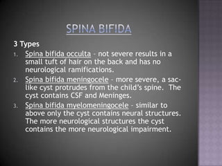 Spina Bifida“forked spine” results from the incomplete formation of the vertebral archesis a developmental birth defect involving the neural tube: incomplete closure of the embryonic neural tube results in an incompletely formed spinal cord. the vertebrae overlying the open portion of the spinal cord do not fully form and remain un fused and open This allows the abnormal portion of the spinal cord to stick out through the opening in the bones 