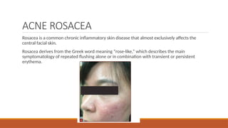 BIOLOGY AND DISORDERS OF SEBACEOUS GLAND [Autosaved].pptx