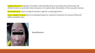 BIOLOGY AND DISORDERS OF SEBACEOUS GLAND [Autosaved].pptx