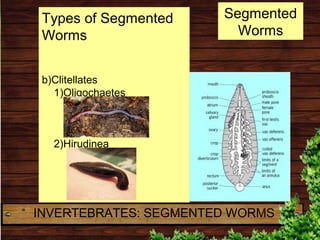 Segmented
Worms
Types of Segmented
Worms
b)Clitellates
1)Oligochaetes
2)Hirudinea
INVERTEBRATES: SEGMENTED WORMS
 