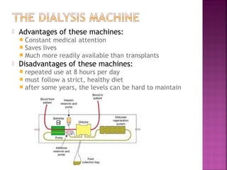 

Advantages of these machines:
 Constant medical attention
 Saves lives
 Much more readily available



than transplants

Disadvantages of these machines:
 repeated use at 8 hours per day
 must follow a strict, healthy diet
 after some years, the levels can be

hard to maintain

 