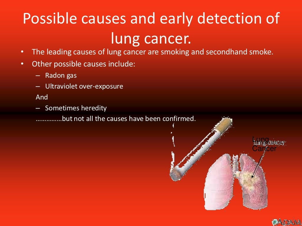 lung cancer