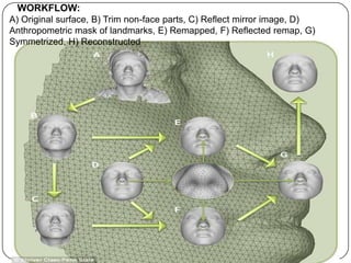 WORKFLOW:
A) Original surface, B) Trim non-face parts, C) Reflect mirror image, D)
Anthropometric mask of landmarks, E) Remapped, F) Reflected remap, G)
Symmetrized, H) Reconstructed
 