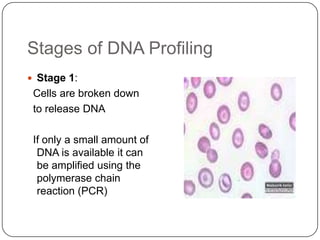 Stages of DNA Profiling
 Stage 1:
Cells are broken down
to release DNA
If only a small amount of
DNA is available it can
be amplified using the
polymerase chain
reaction (PCR)
 