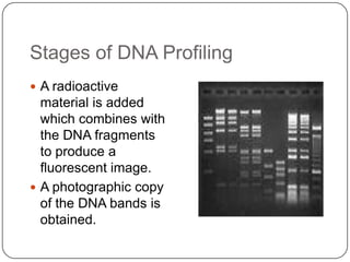 Stages of DNA Profiling
 A radioactive
material is added
which combines with
the DNA fragments
to produce a
fluorescent image.
 A photographic copy
of the DNA bands is
obtained.
 