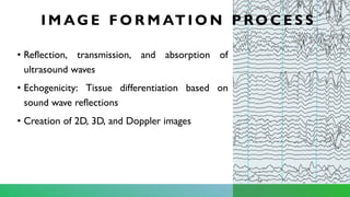 • Reflection, transmission, and absorption of
ultrasound waves
• Echogenicity: Tissue differentiation based on
sound wave reflections
• Creation of 2D, 3D, and Doppler images
I M AG E F O R M AT I O N P RO C E S S
 