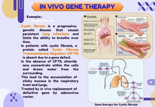 IN VIVO GENE THERAPY
Example:-
Cystic Fibrosis
Cystic fibrosis is a progressive,
genetic disease that causes
persistent lung infections and
limits the ability to breathe over
time.
In patients with cystic fibrosis, a
protein called Cystic Fibrosis
Transmembrane Regulator (CFTR)
is absent due to a gene defect.
In the absence of CFTR, chloride
ions concentrate within the cells
and draws water from the
surrounding.
This lead to the accumulation of
sticky mucous in the respiratory
tract and lungs.
12
Treated by in vivo replacement of
defective gene by adenovirus
vector.
Gene therapy for Cystic fibrosis
 