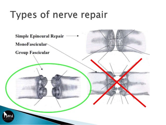 Biology of nerve injury and repair