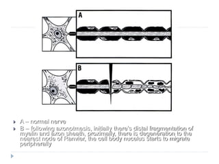 Biology of nerve injury and repair | PPTX
