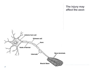 Axotomy Biology of nerve injury and repair | PPTX