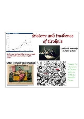 History and Incidence
                                               of Crohn's
                                                        Rembrandt paints the
                                                          anatomy picture
Crohn's was first described as early as 1632 and
wasn't formally named until 1960 by Mr.
Crohn.



Often confused with intestinal                                  Drawing by
        tuberculosis!!!                                         Champlain
                                                                of Ottawa
                                                                Valley in
                                                                1632; La
                                                                Nouuelle
                                                                France
 