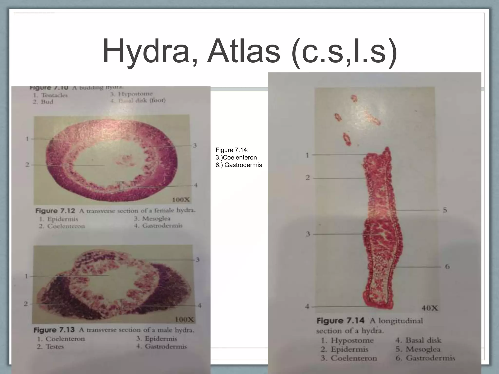 Hydra, Atlas (c.s,l.s)

        Figure 7.14:
        3.)Coelenteron
        6.) Gastrodermis
 