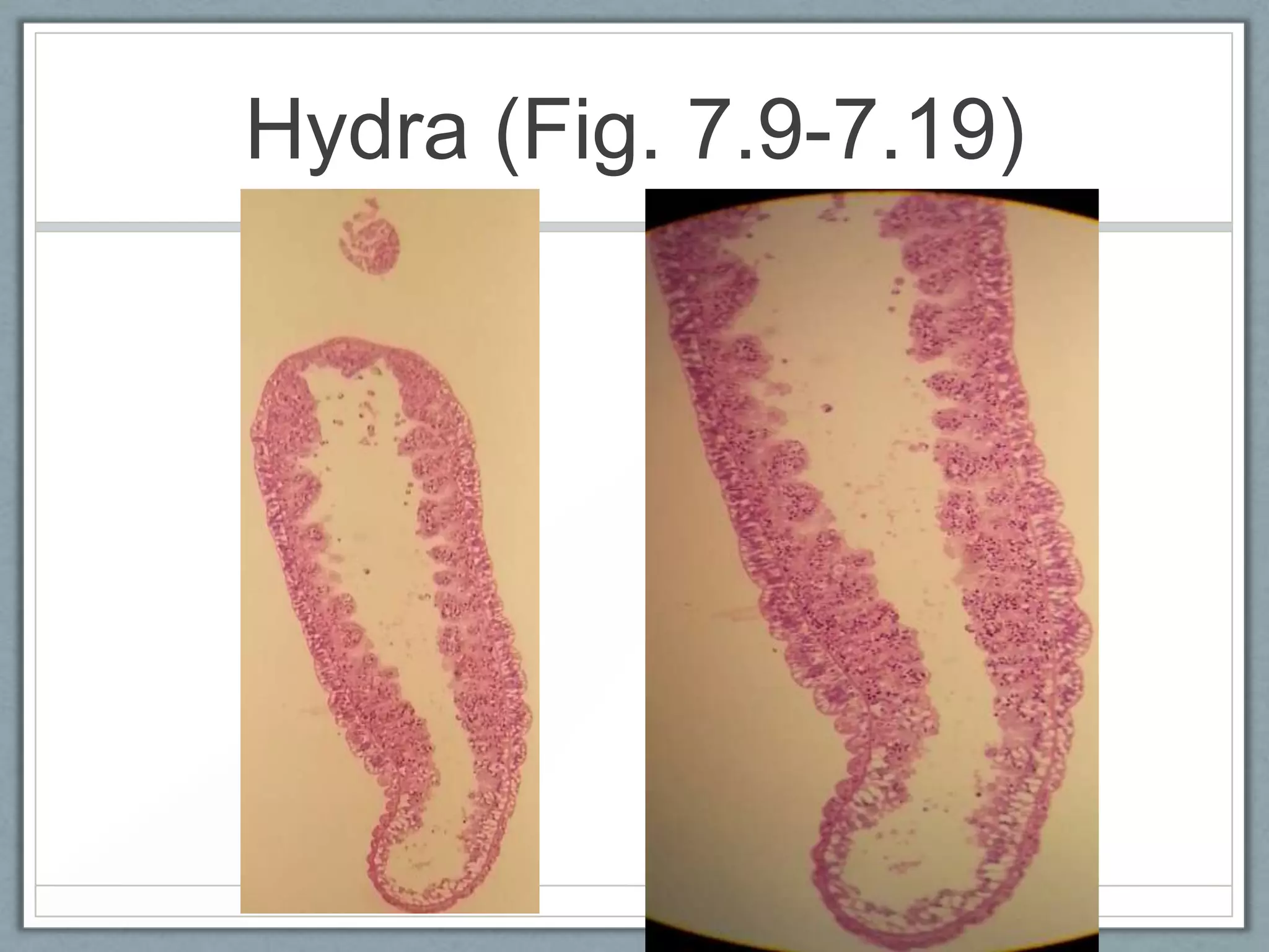 Hydra (Fig. 7.9-7.19)
 